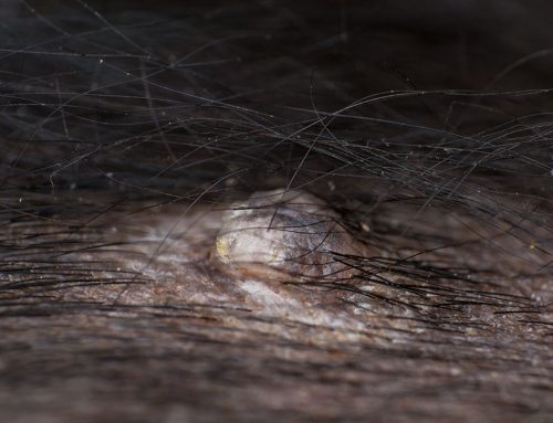 Beneath the Fur: Identifying Emergency Masses in Your Pet